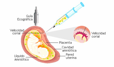 biopsia